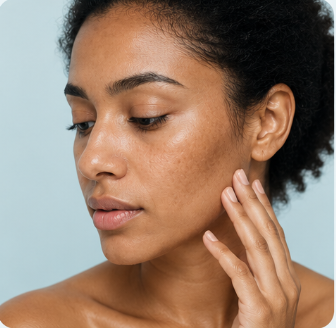 Uneven Skin Tone